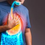 GERD and Sleep Disorders